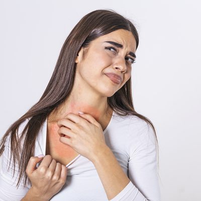 Food allergies on the rise, specifically in children