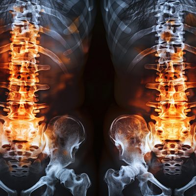 Have a chronic condition? You may qualify for these benefits